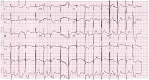 Señal de electrocardiograma.